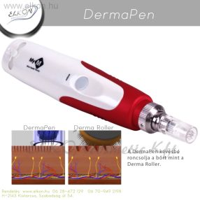 MTS Mezopen készülék + Betanítás